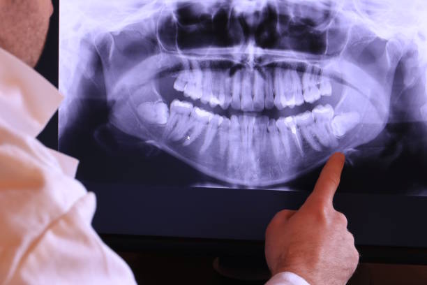 Best Emergency Tooth Extraction in Capac, MI