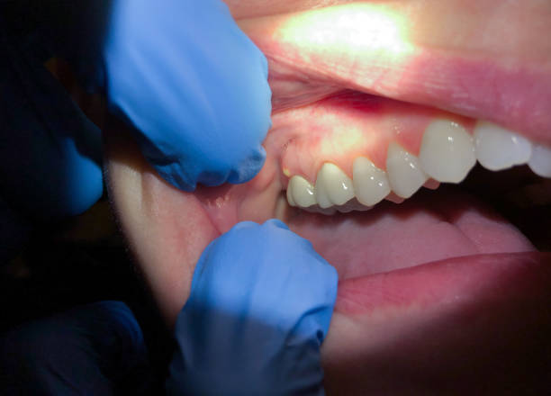 Best Weekend Emergency Dentist in Capac, MI