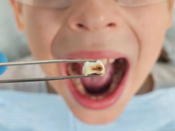 Best Emergency Denture Repair in Capac, MI